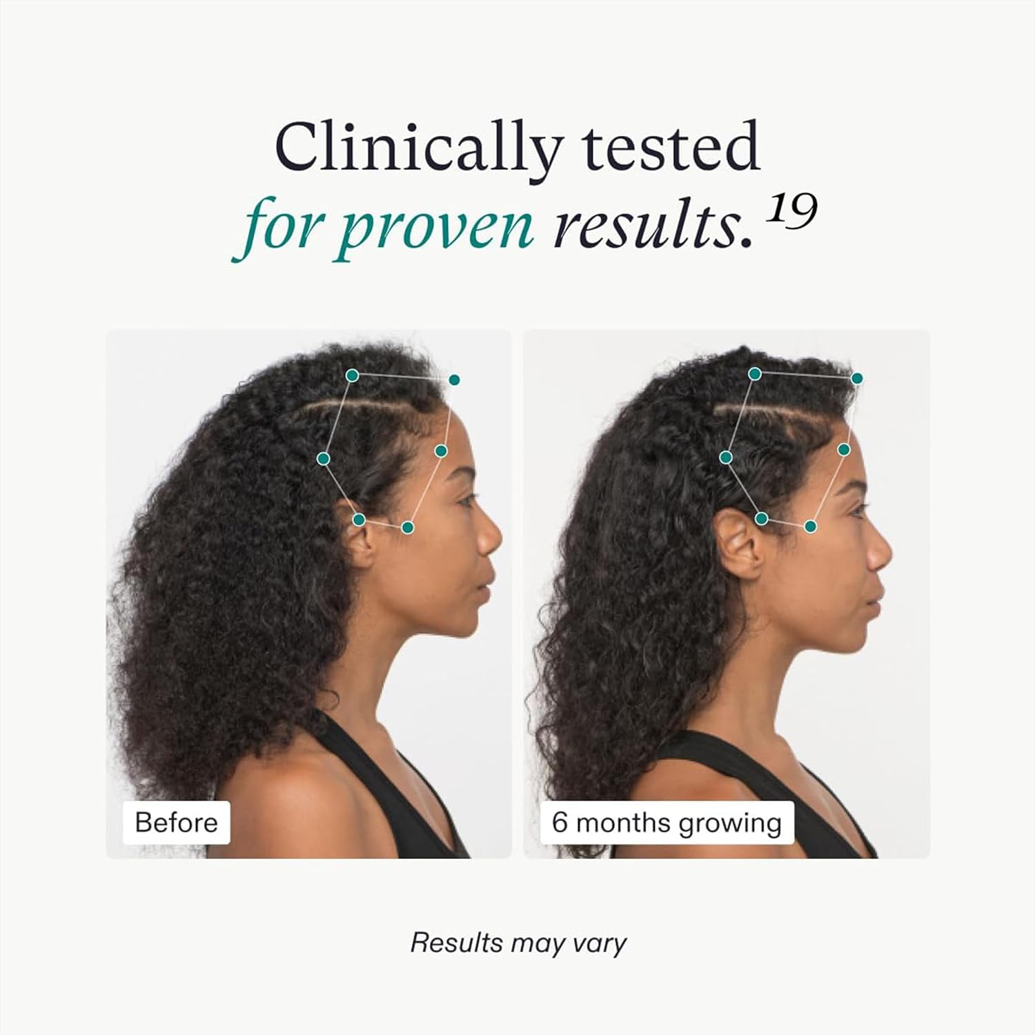 Nutrafol VEGAN Womans Hair Growth Supplement, 3-Month Supply, For Women 18-44 Years Old, Pack of 3 - Image 12