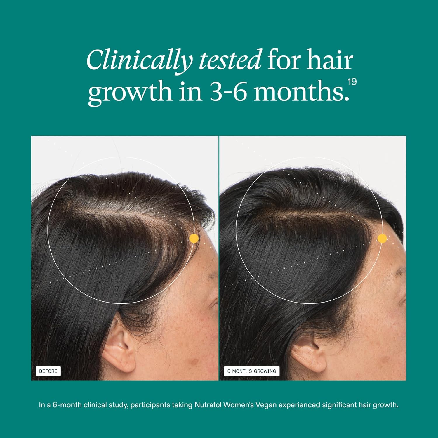 Nutrafol VEGAN Womans Hair Growth Supplement